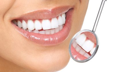 Brighten Your Smile With Teeth Whitening in Cheyenne, WY
