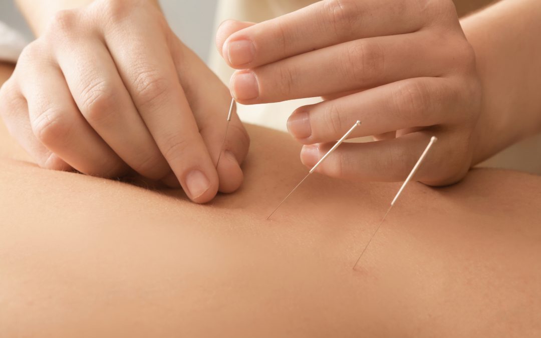 Gain Expertise: Acupuncture CEU Courses Texas Awaits
