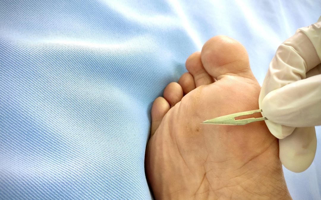 Relief from Heel Pain Starts with Effective Plantar Fasciitis Treatment in Norfolk, VA