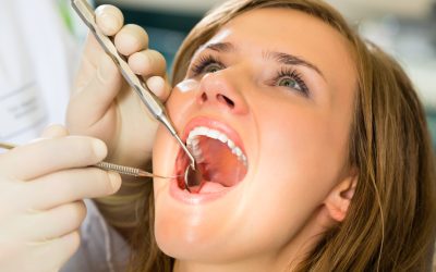 Key Insights About Root Canal Treatments Loma Linda CA Locals Should Know