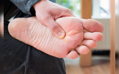 Relieve Your Foot Discomfort With Proven Heel Pain Manalapan NJ Treatment Solutions