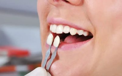 Achieve a Confident Smile with Invisalign Burlington, NC for Teens and Adults