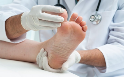 Preventing Complications with Diabetic Foot Care in Cypress, TX, Patients Can Rely On