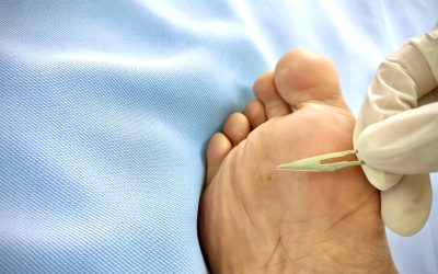 Essential Steps for Diabetic Foot Care Cypress, TX Residents Can Follow at Home