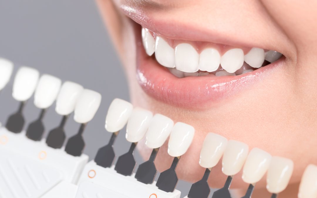 Achieve Your Perfect Smile with a Cosmetic Dentist Near Modern Dental Solutions and Me