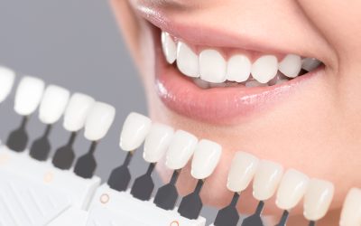 Achieve Your Perfect Smile with a Cosmetic Dentist Near Modern Dental Solutions and Me
